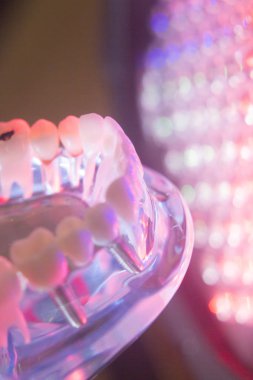 Diş diş kökleri modeli