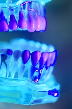 Diş diş çene modeli