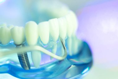 Diş diş dişçi modeli