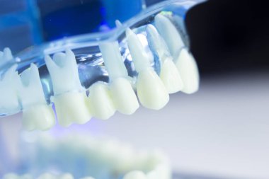 Diş diş dişçi modeli