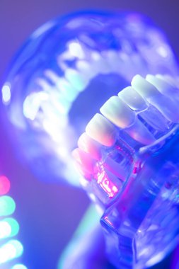 Ortodontik diş diş modeli