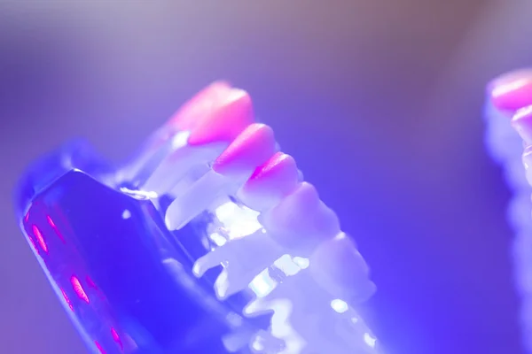 Model dentystyczny zdrowe zęby — Zdjęcie stockowe
