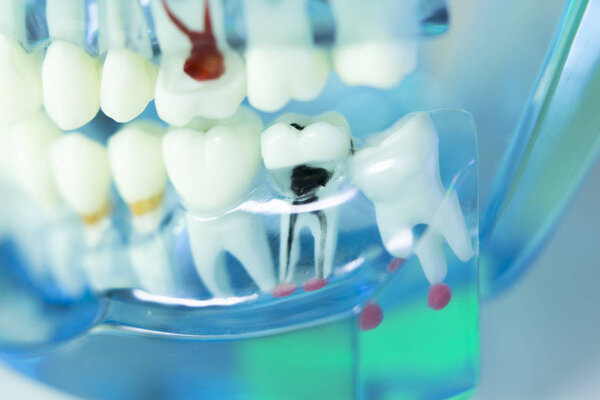 Dental teeth dentist model