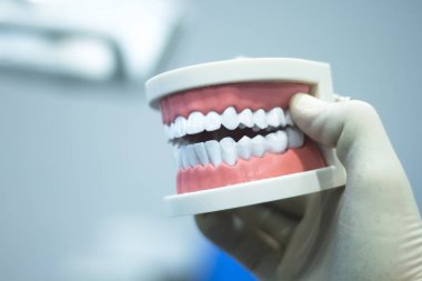 Diş diş ağız modeli