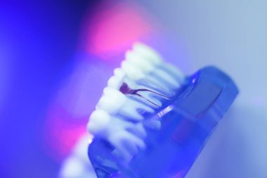 Diş diş diş modeli