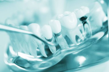 Diş diş dişçi modeli