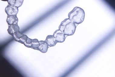 Görünmez diş aligners diş telleri
