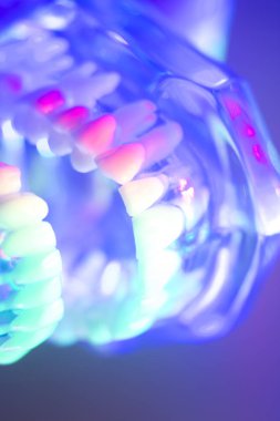 Ortodontik diş diş modeli