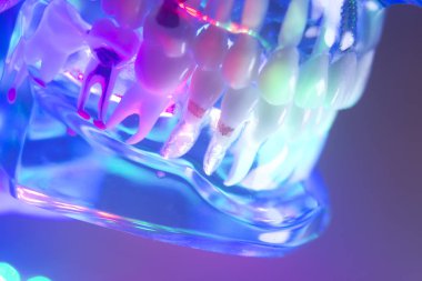 Ortodontik diş diş modeli