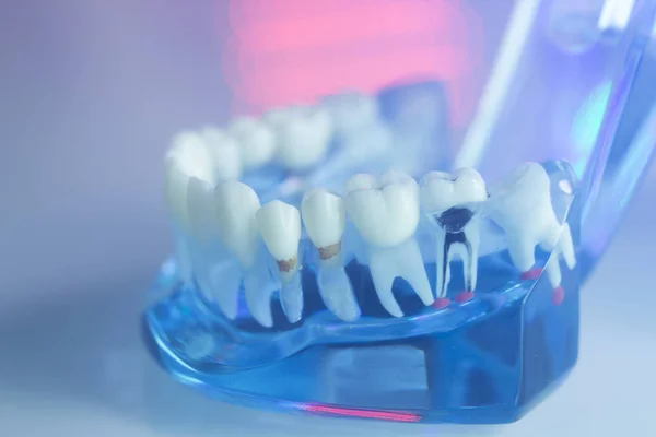 Denti dentisti modello — Foto Stock