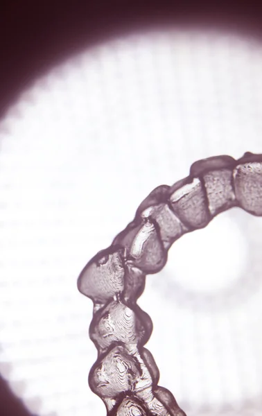 Невидимая скобка для выравнивания зубов — стоковое фото