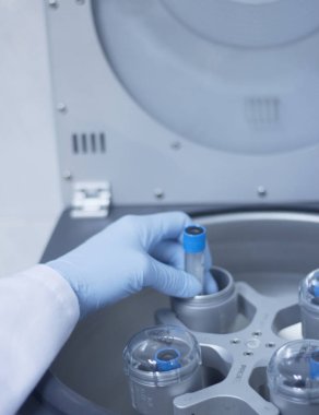 Trombosit zengin plazma laboratuvar