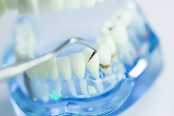 Zębów dentystycznych dentysta modelu — Zdjęcie stockowe