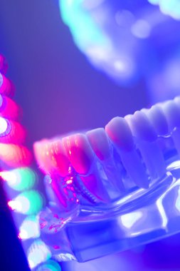 Ortodontik diş diş modeli