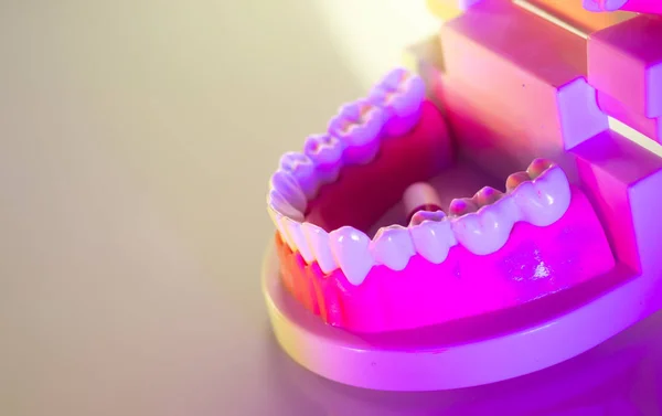 Zębów dentystycznych stomatologicznych modelu — Zdjęcie stockowe