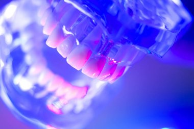 Ortodontik diş diş modeli