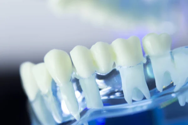 Modelo dentista de dientes dentales —  Fotos de Stock