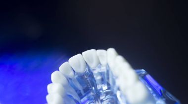 Diş hizalama diş modeli