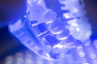 Diş diş kökleri modeli