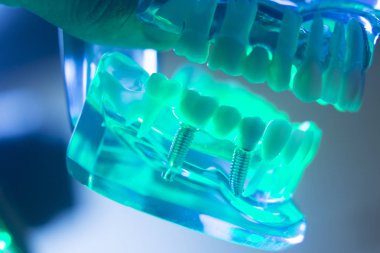 Diş ağız diş modeli