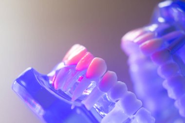 Diş sağlıklı diş modeli