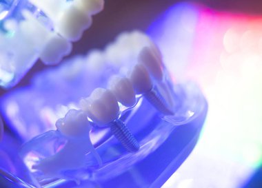 Diş diş kökleri modeli