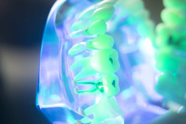 Diş ağız diş modeli