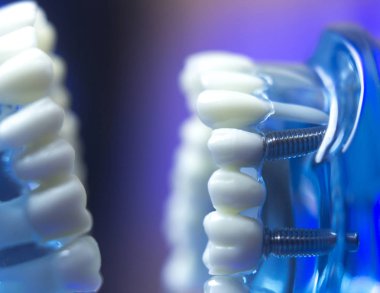 Diş diş ağız sağlığı