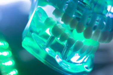 Diş ağız diş modeli