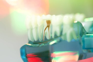 Diş diş diş hekimleri modeli