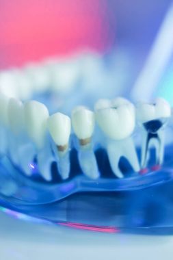 Diş diş dişçi modeli