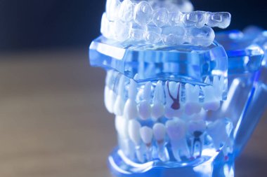 Diş diş kök modeli