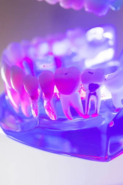 Zubní zdravé zuby model — Stock fotografie