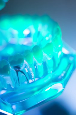 Diş ağız diş modeli