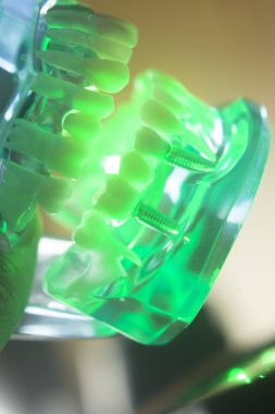 Diş ağız diş modeli