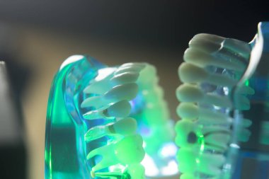 Diş ağız diş modeli