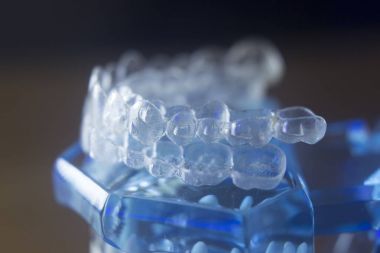 Diş diş bracets modeli