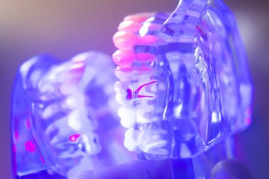 Diş sağlıklı diş modeli