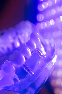 Diş diş kökleri modeli