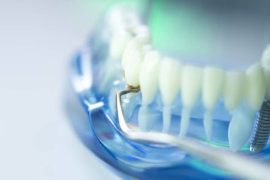 Diş diş dişçi modeli