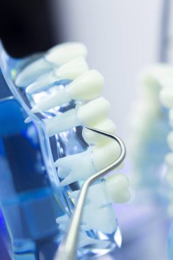 Diş diş dişçi modeli