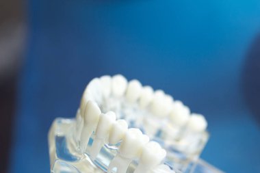 Diş diş ağız modeli