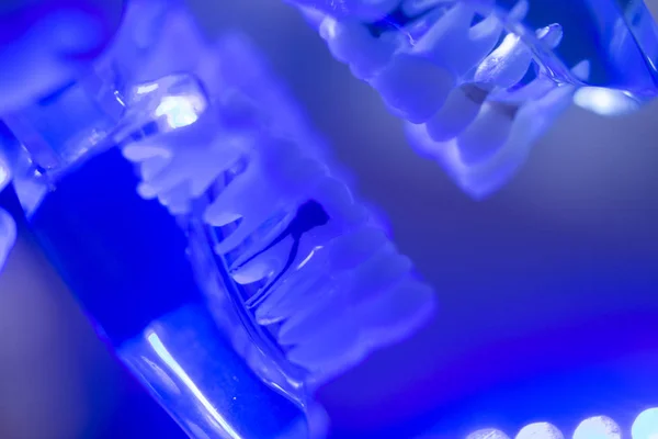 Modello di mascella dentale denti — Foto Stock