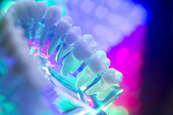 Tandläkare tänder modell — Stockfoto