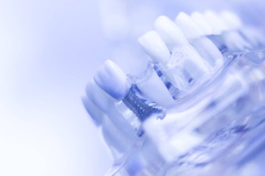 Dentsts diş diş modeli