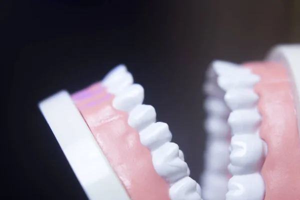 Modelo de dientes dentales — Foto de Stock