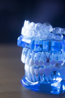 Diş diş kök modeli