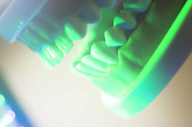 Diş ağız diş modeli