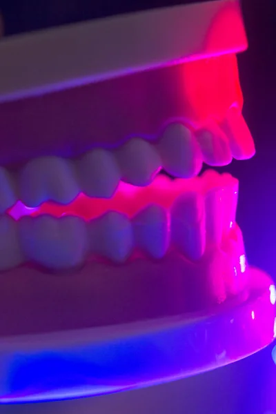 Модель щелепи зубів — стокове фото