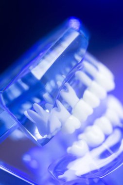 Diş hizalama diş modeli